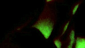 getting a new tattoo with braces on, it's so cool