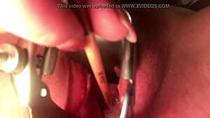 Can you believe how the cervix stretches and sounds?