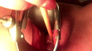 Can you believe how the cervix stretches and sounds?