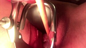 Can you believe how the cervix stretches and sounds?