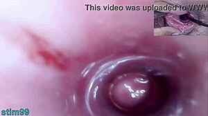 Lesbická extrémna hra s krčkom s dildom na močovú trubicu