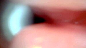 Endoscope Camera Records Male Ejaculation Moment