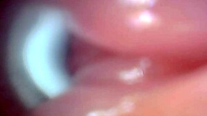 Endoscope Camera Records Male Ejaculation Moment