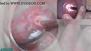 Mature Japanese milf endoscope probes deep cervix uterus cam