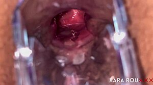 she spreads hairy huge ass for speculum ANAL GAPING