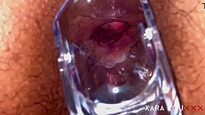 she spreads hairy huge ass for speculum ANAL GAPING