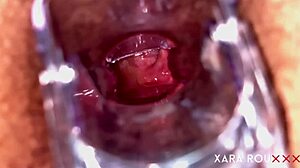 she spreads hairy huge ass for speculum ANAL GAPING