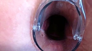 Milf Big Ass Gaping Anal Vagina Stretched Speculum Gyno Exam